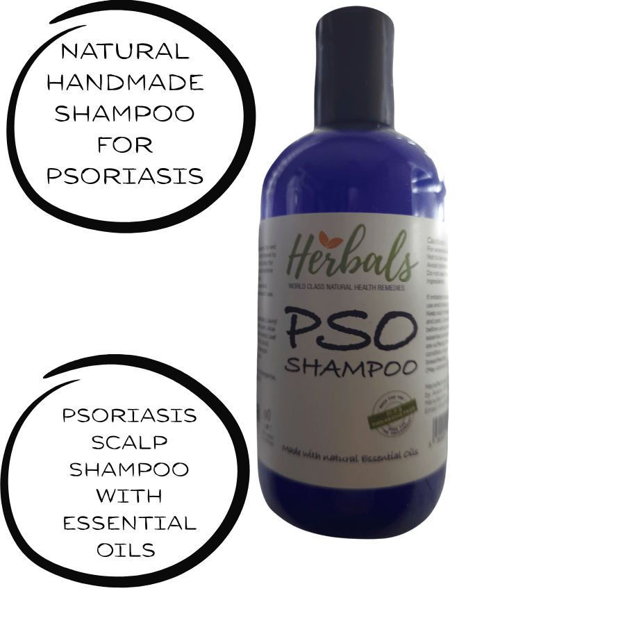 PSO Herbal Scalp Care Shampoo - Effective Dandruff Treatment & Soothing Psoriasis Relief - Herbalshire Handmade Herbal Products