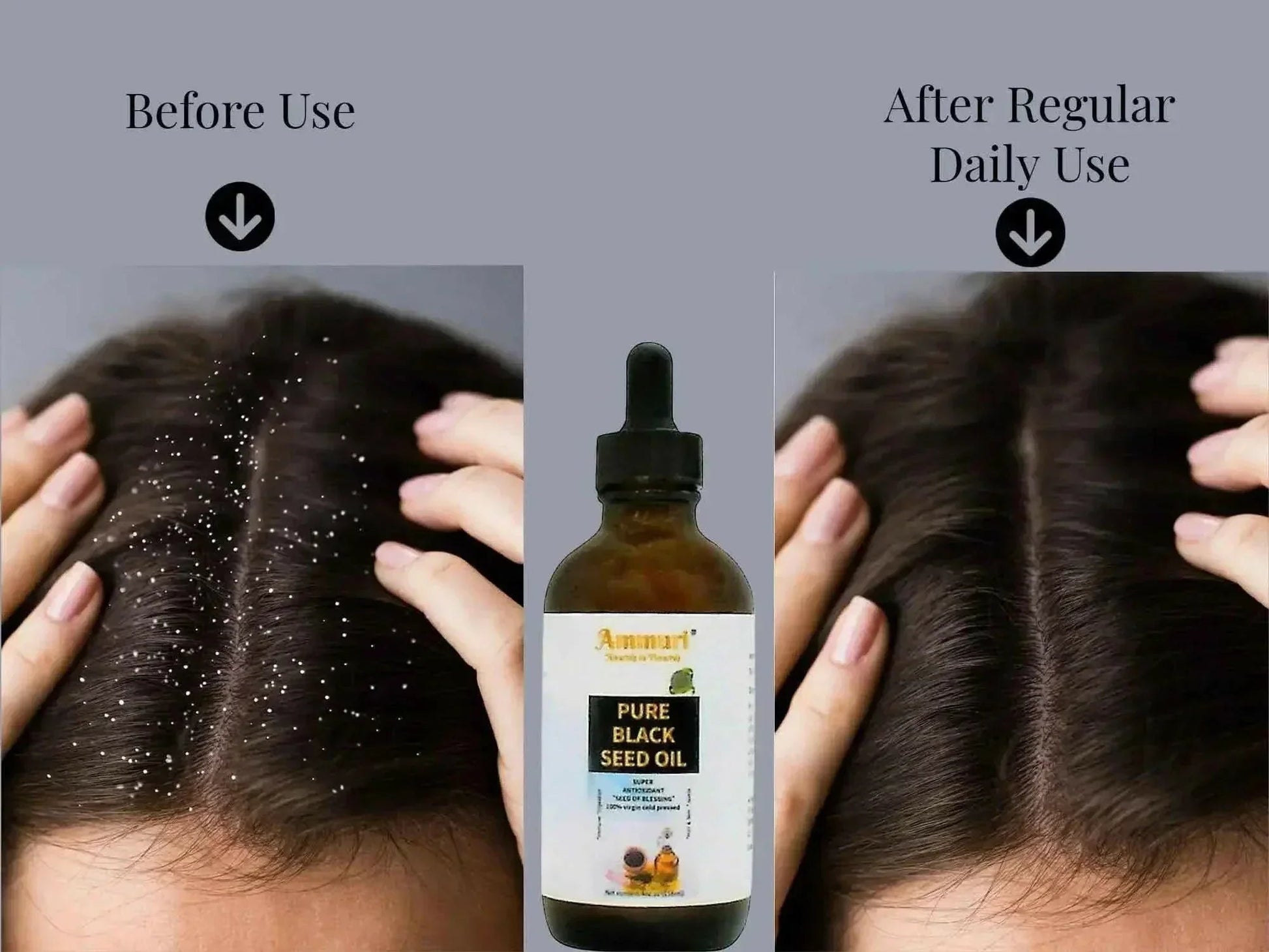 Pure Organic Black Seed Oil | Cold - Pressed Nigella Sativa for Skin, Hair & Wellness – Ammuri Beauty - Herbalshire Handmade Herbal Products