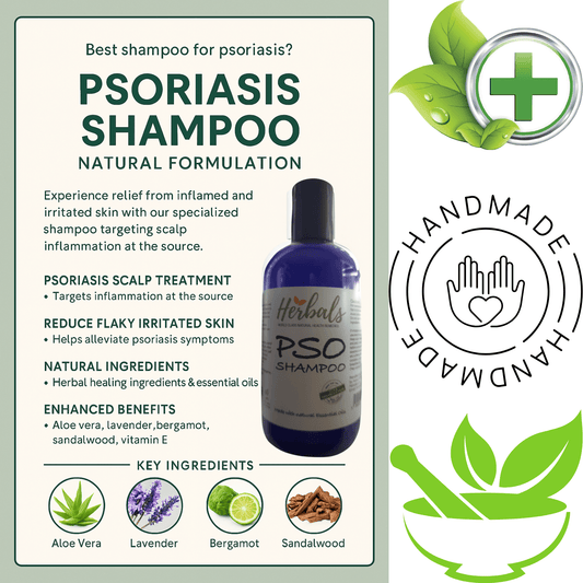 Scalp Psoriasis Treatment Shampoo Natural Handmade Relief for Flaky Itchy Scalp - Herbalshire Handmade Herbal Products