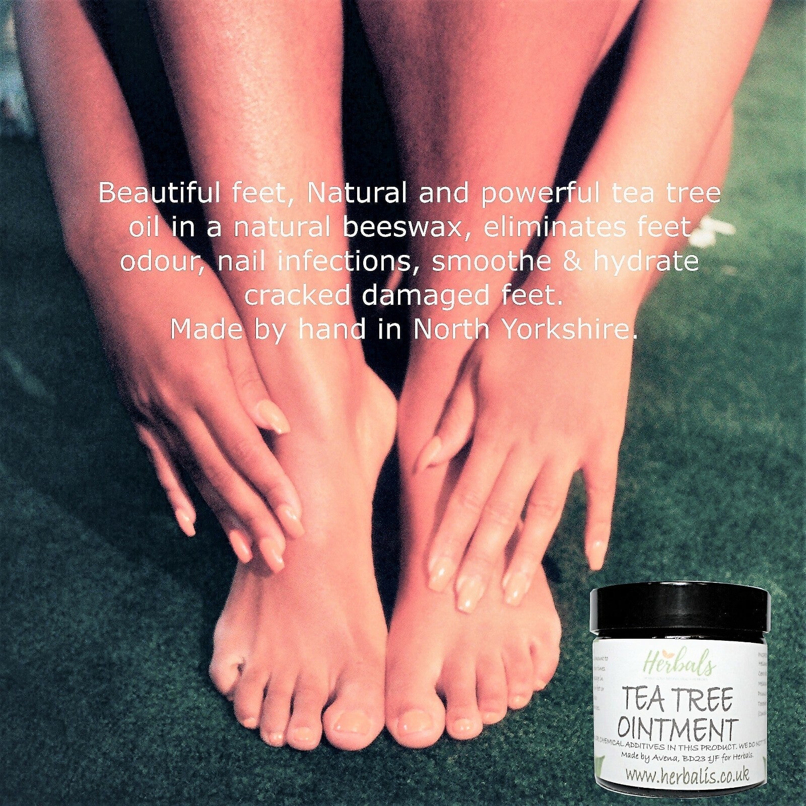 Tea Tree Ointment – Natural Balm for Acne, Psoriasis, Eczema & Skin Tags – 60ml / 120ml / 200ml - Herbalshire Handmade Herbal Products